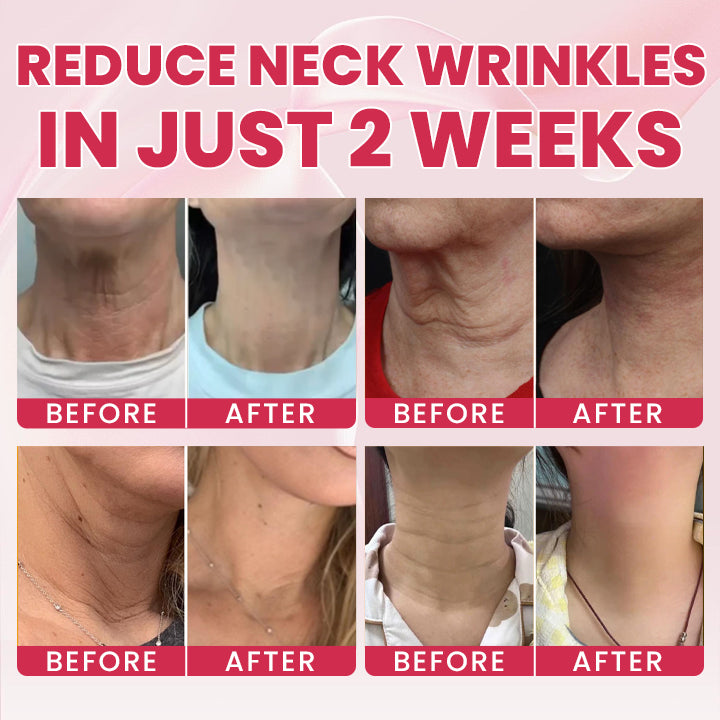 LIMETOW® Lift - Become the Woman Who Loves Her Neck Again