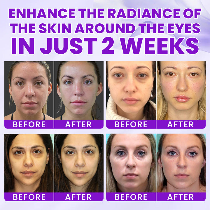 LIMETOW®  0.1% Caffeine Revitalizing Eye Cream
