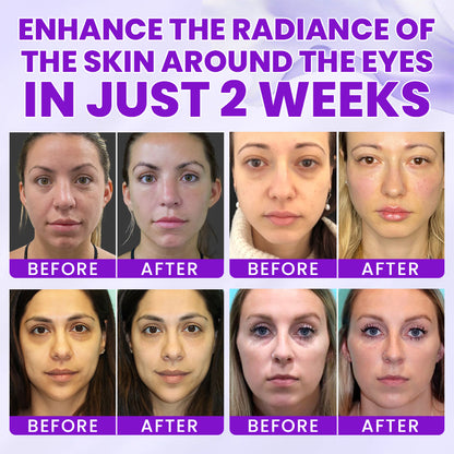 LIMETOW®  0.1% Caffeine Revitalizing Eye Cream