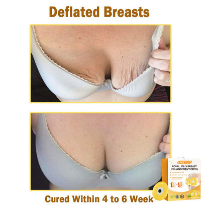 【Official Flagship Store】LIMETOW® 🩰 Royal Jelly Breast Enhancement Patch Safe for use during breastfeeding