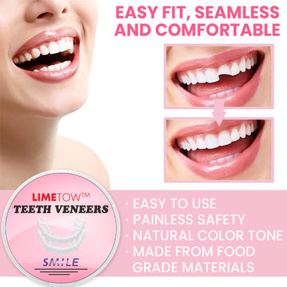 LIMETOW™ Love Your Smile with Custom-Made Veneers