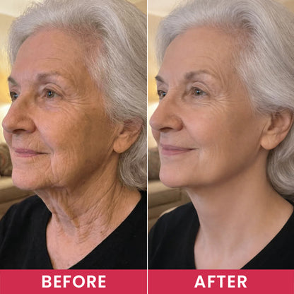 LIMETOW® Lift - Become the Woman Who Loves Her Neck Again