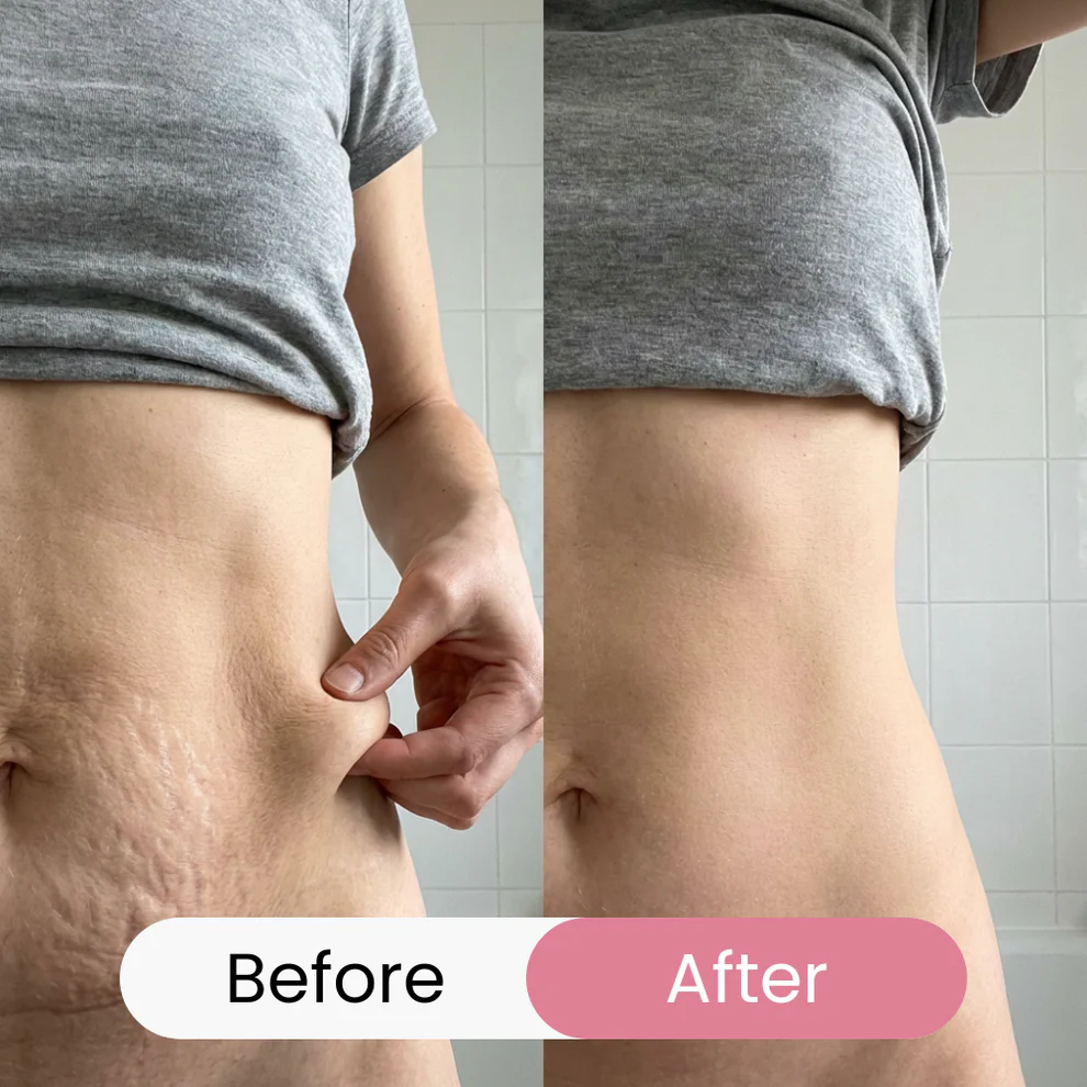 LIMETOW® REVERSE-AGING BODY OIL