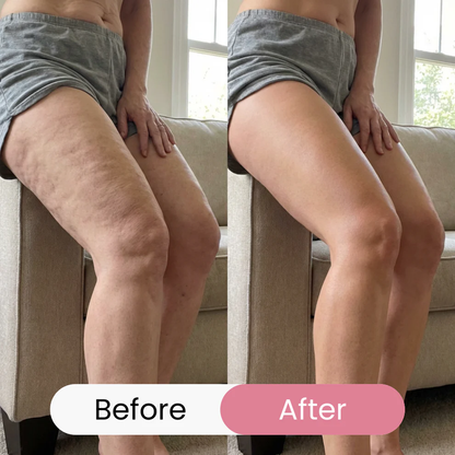 LIMETOW® REVERSE-AGING BODY OIL