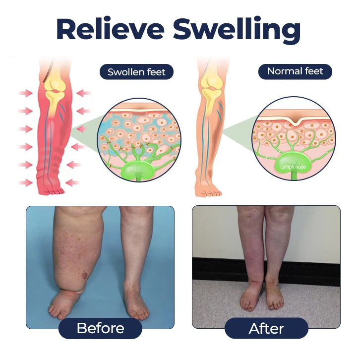 Alcuras® SwellRelief Circulation Support Cream🇺🇸