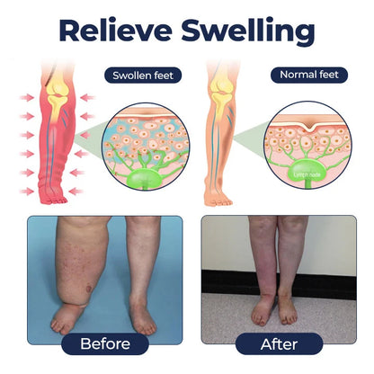 Alcuras® SwellRelief Circulation Support Cream🇺🇸