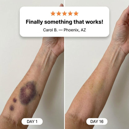 💥150K+ SOLD💕- LIMETOW® Bruise Repair & Skin-Strengthening Cream