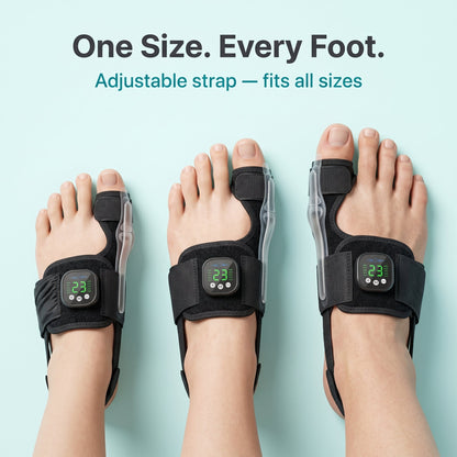 Nexalign Pro — EMS Bunion Corrector
