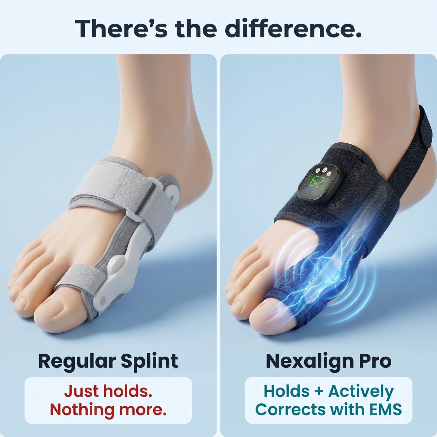 Nexalign Pro — EMS Bunion Corrector