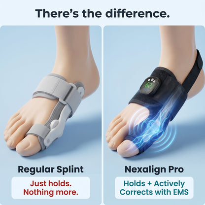 Nexalign Pro — EMS Bunion Corrector