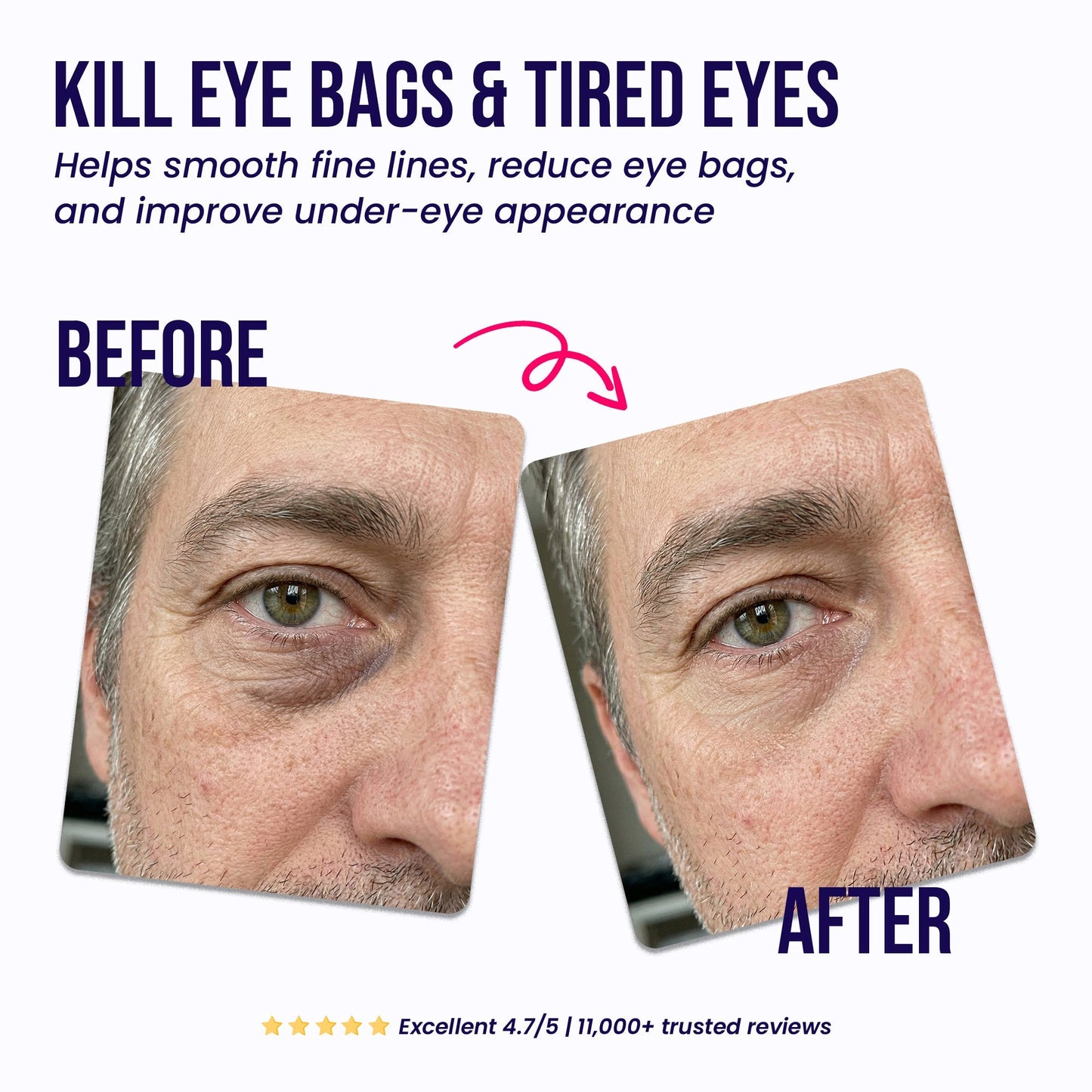 LIMETOW®  Under-Eye Repair Patches